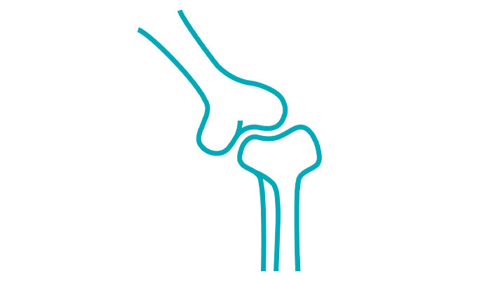 stylized graphic depiction of a knee bone